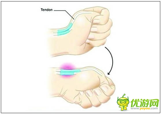 玩手機易患十大“智能手機病” 這些癥狀你都有嗎？